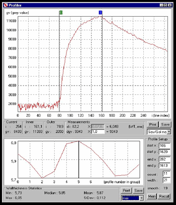 profilogram